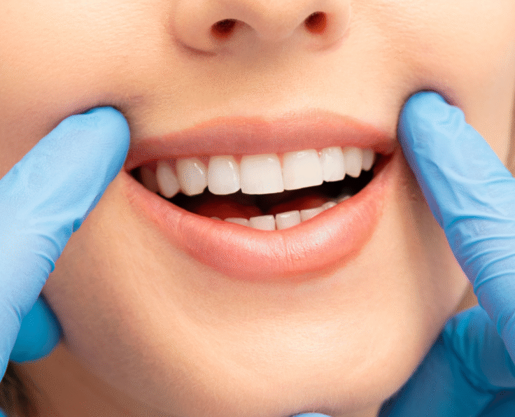 Teeth Cleaning banner