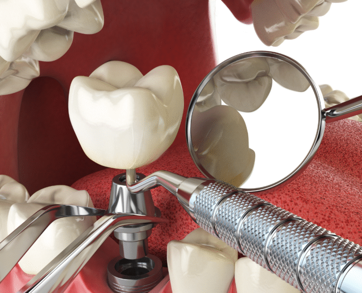 Cosmetic Bonding banner