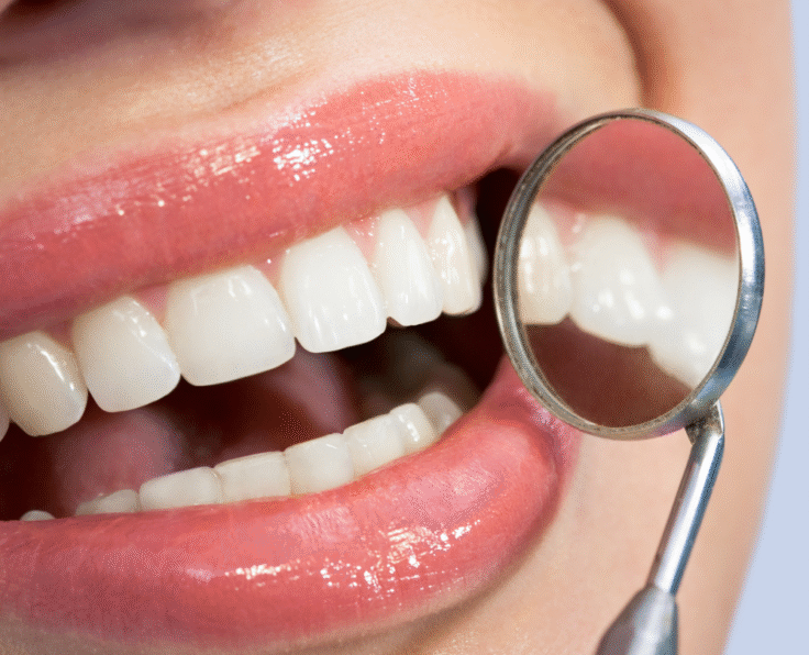 Smile Makeovers banner